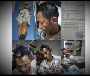 Sadis!! Empat Preman di Kelurahan Terjun Culik dan Aniaya Rudi Hingga Sekarat, Polisi Gercep Kejar Pelaku