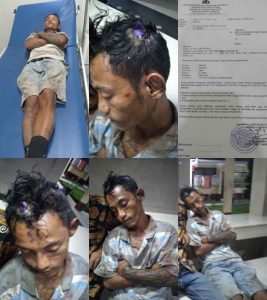 Masih Satu Tersangka Ditangkap, Polsekta Medan Labuhan Belum Menangkap Tersangka Lain Penganiayaan Irrudi pada Mei 2023 Lalu